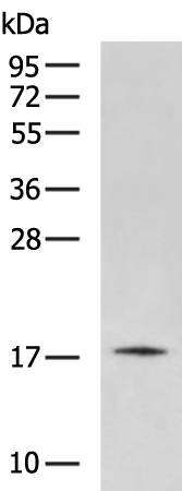 Rabbit Polyclonal Antibody to RFK