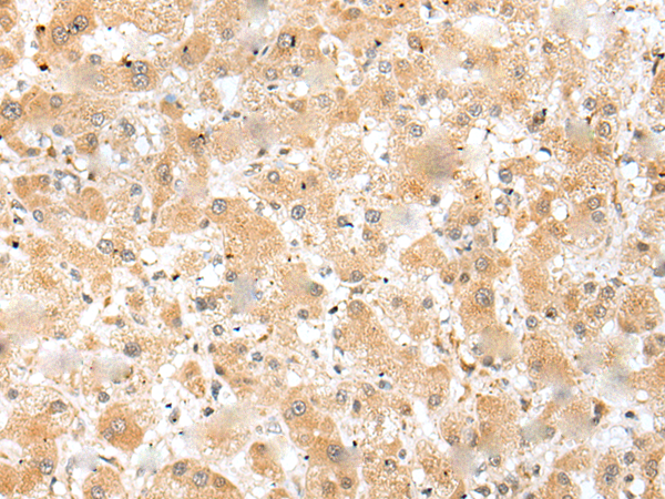 Rabbit Polyclonal Antibody to DHDH