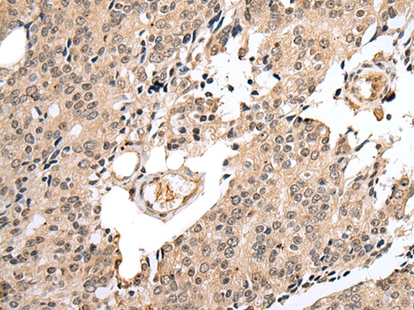 Rabbit Polyclonal Antibody to GTF2H2