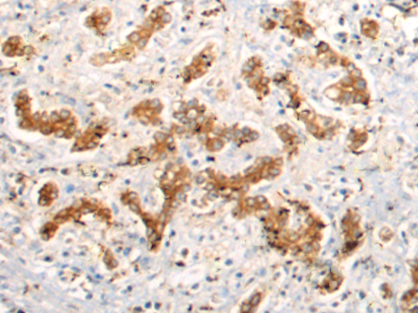 Rabbit Polyclonal Antibody to LSAMP