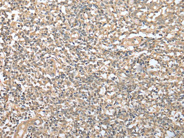 Rabbit Polyclonal Antibody to DPYD