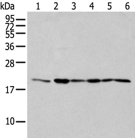 Rabbit Polyclonal Antibody to EEF1E1