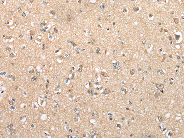 Rabbit Polyclonal Antibody to DYDC2