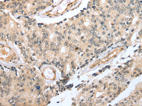 Rabbit Polyclonal Antibody to TRNAU1AP