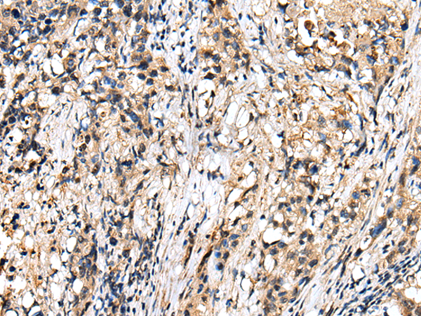 Rabbit Polyclonal Antibody to RHEBL1