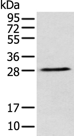 Rabbit Polyclonal Antibody to DENR