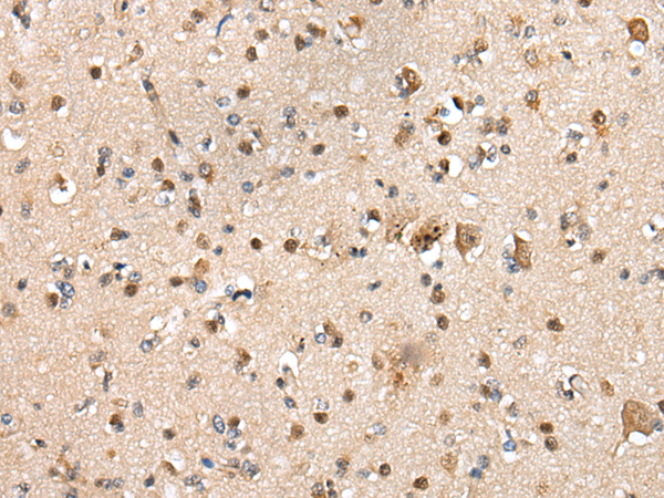 Rabbit Polyclonal Antibody to RILPL2