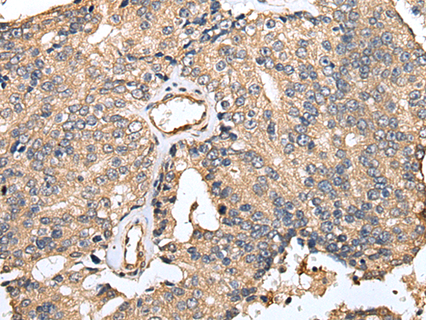 Rabbit Polyclonal Antibody to TESC
