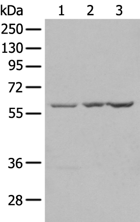 Rabbit Polyclonal Antibody to SETD3