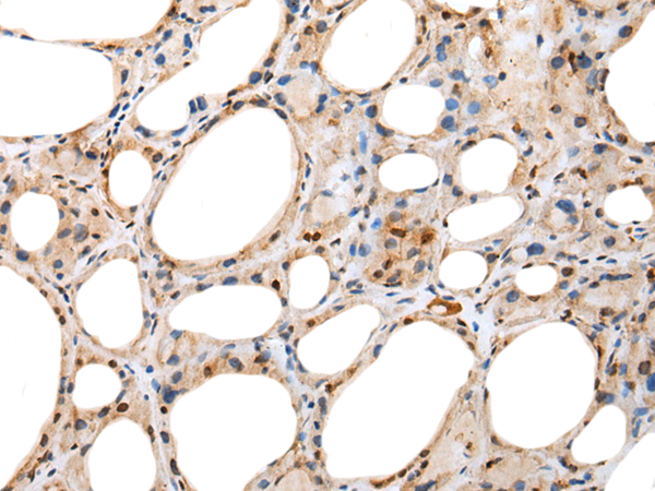 Rabbit Polyclonal Antibody to MOB1B