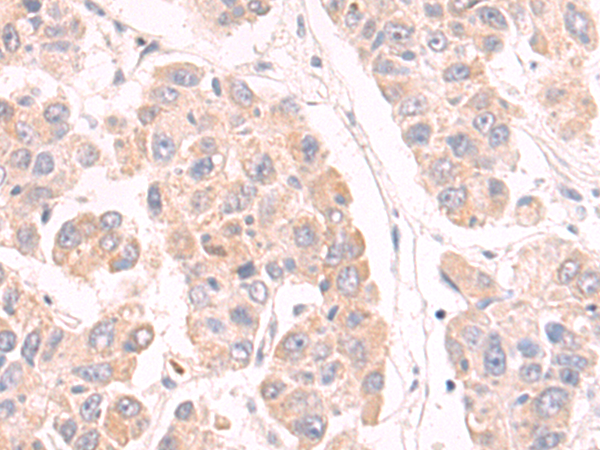 Rabbit Polyclonal Antibody to PLA2G4D