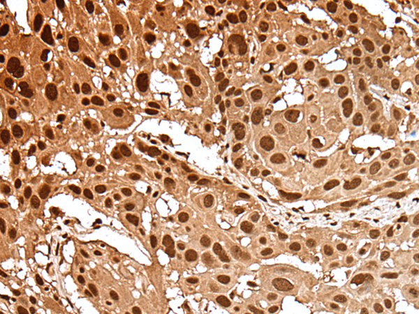 Rabbit Polyclonal Antibody to GAR1