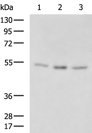 Rabbit Polyclonal Antibody to TINAGL1