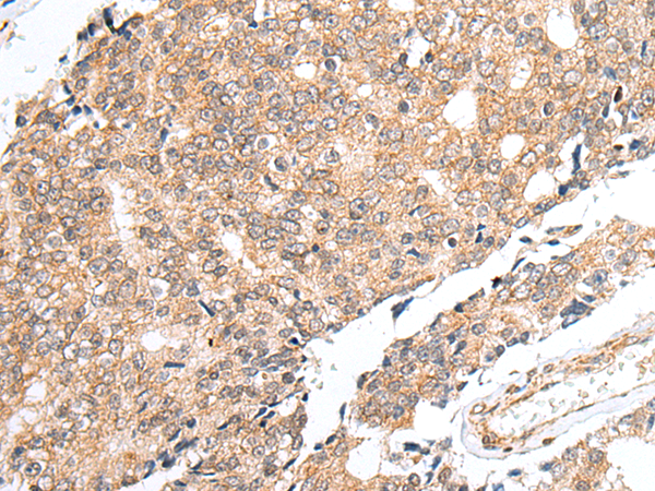 Rabbit Polyclonal Antibody to PRELID1