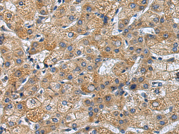 Rabbit Polyclonal Antibody to TRAPPC4