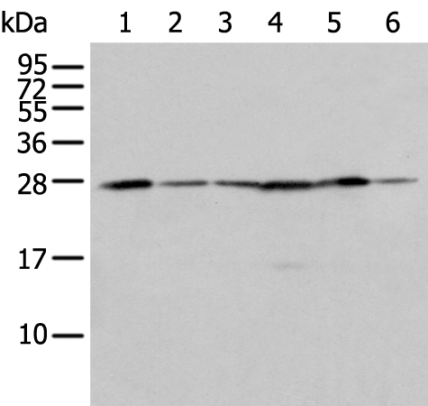 Rabbit Polyclonal Antibody to FKBP7