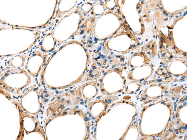 Rabbit Polyclonal Antibody to DNAAF5