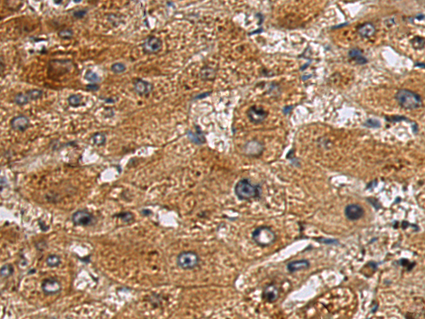Rabbit Polyclonal Antibody to DNAJB9