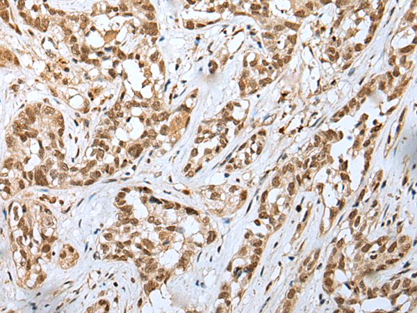 Rabbit Polyclonal Antibody to GINS4