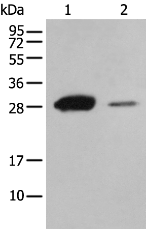 Rabbit Polyclonal Antibody to ATP6V1E2