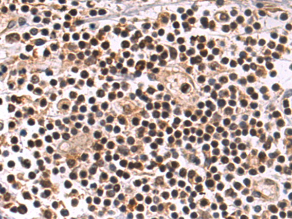 Rabbit Polyclonal Antibody to RNF114