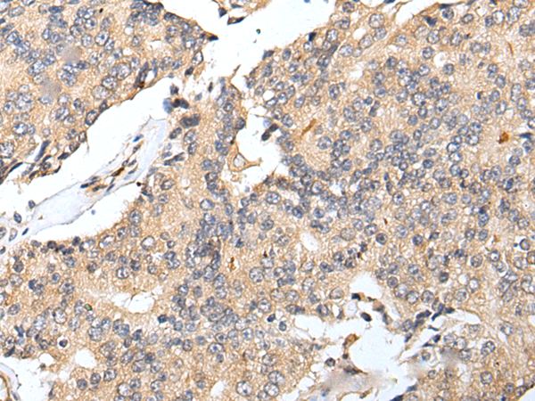 Rabbit Polyclonal Antibody to RNF141