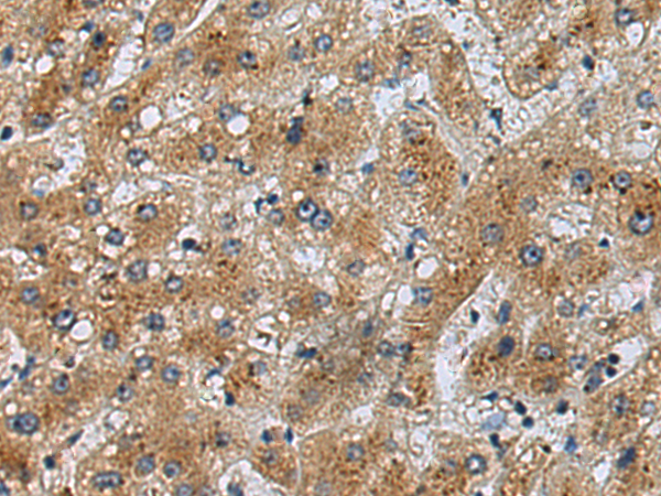 Rabbit Polyclonal Antibody to LYPLA2