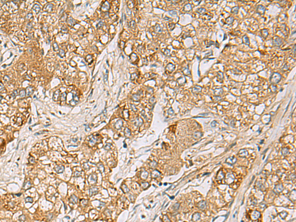 Rabbit Polyclonal Antibody to LRRC28