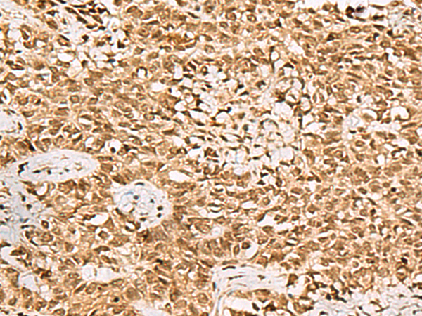 Rabbit Polyclonal Antibody to LRRC2