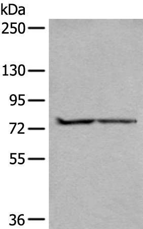 Rabbit Polyclonal Antibody to ALKBH8