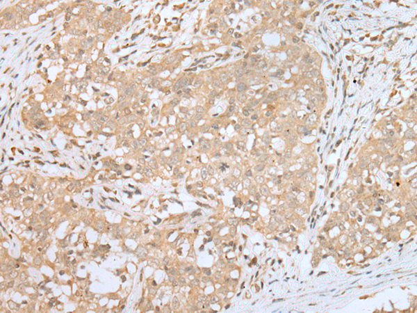 Rabbit Polyclonal Antibody to NAA60