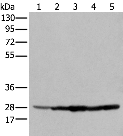 Rabbit Polyclonal Antibody to ECI1