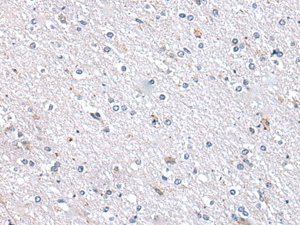 Rabbit Polyclonal Antibody to METTL7A