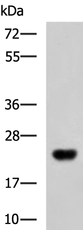 Rabbit Polyclonal Antibody to C1QC