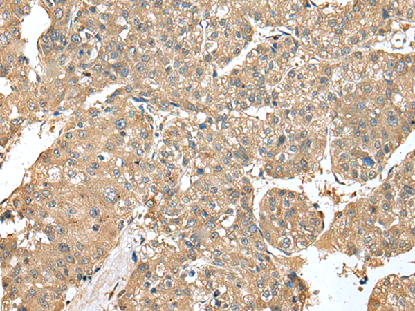 Rabbit Polyclonal Antibody to UBE2Z
