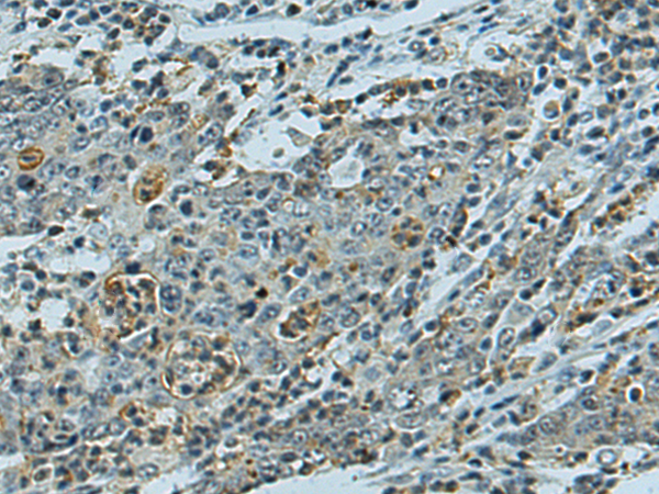 Rabbit Polyclonal Antibody to LIN37