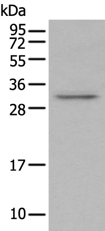 Rabbit Polyclonal Antibody to NSMCE2