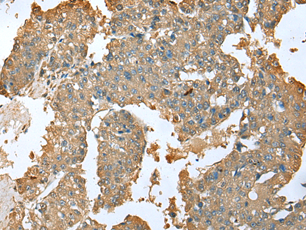 Rabbit Polyclonal Antibody to SFN