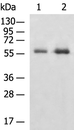 Rabbit Polyclonal Antibody to UGT3A1