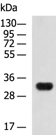 Rabbit Polyclonal Antibody to NIPA1