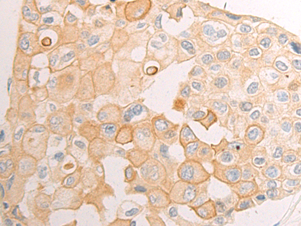 Rabbit Polyclonal Antibody to MIF4GD