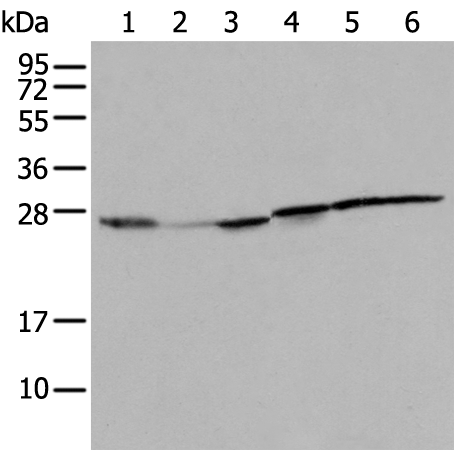 Rabbit Polyclonal Antibody to RPL8