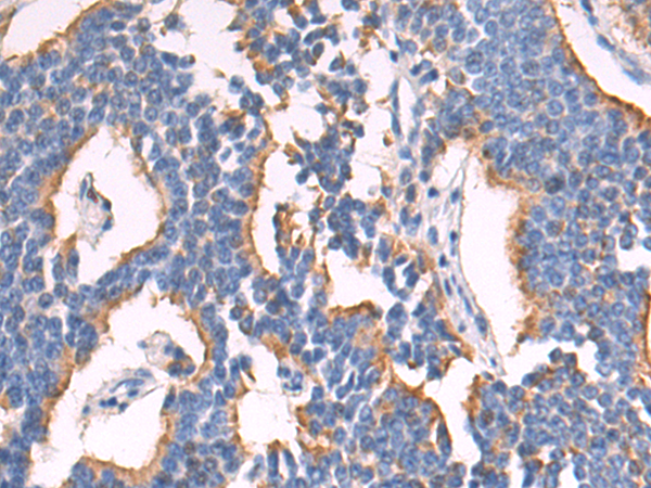 Rabbit Polyclonal Antibody to SNF8