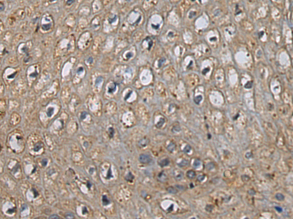 Rabbit Polyclonal Antibody to CISH