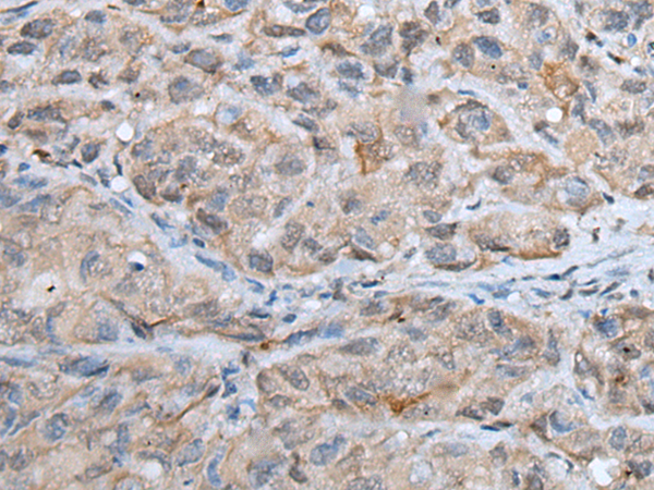 Rabbit Polyclonal Antibody to DPM1