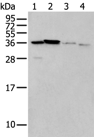 Rabbit Polyclonal Antibody to LASP1