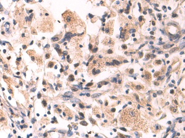 Rabbit Polyclonal Antibody to ZNF473