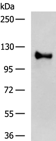 Rabbit Polyclonal Antibody to ZNF281