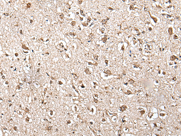 Rabbit Polyclonal Antibody to ZFP36