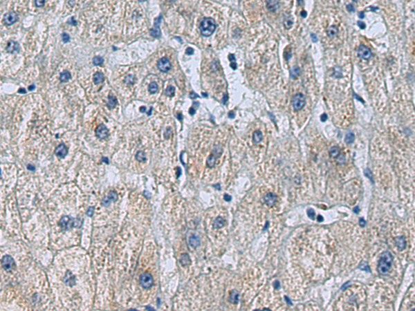 Rabbit Polyclonal Antibody to ZFYVE1